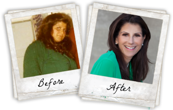 Laura Before and After 100 pound weight loss